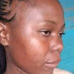 Precious Molokomme Fights for Justice After Surviving Brutal Attack by Ex-Boyfriend